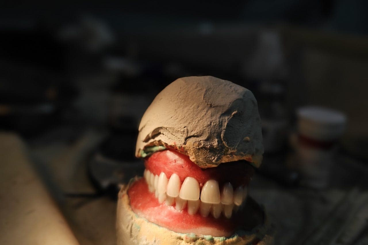 Full set of dentures on a dental model in a dental lab